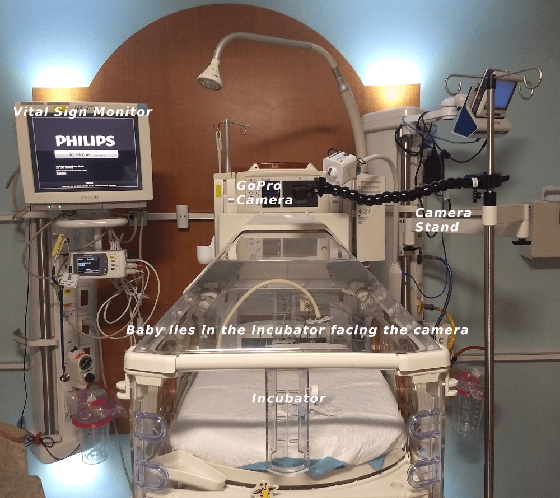 Figure 1 for First Investigation Into the Use of Deep Learning for Continuous Assessment of Neonatal Postoperative Pain