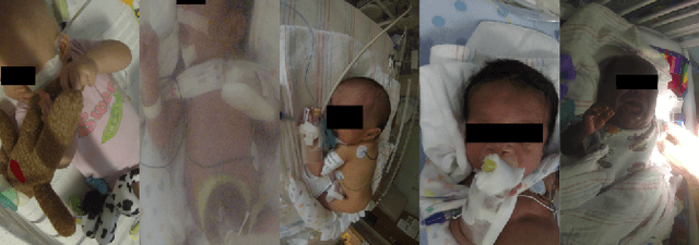 Figure 2 for First Investigation Into the Use of Deep Learning for Continuous Assessment of Neonatal Postoperative Pain