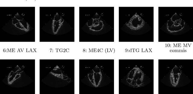 Figure 2 for Automated Performance Assessment in Transoesophageal Echocardiography with Convolutional Neural Networks