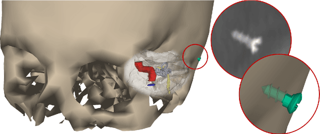 Figure 1 for How Bad is Good enough: Noisy annotations for instrument pose estimation