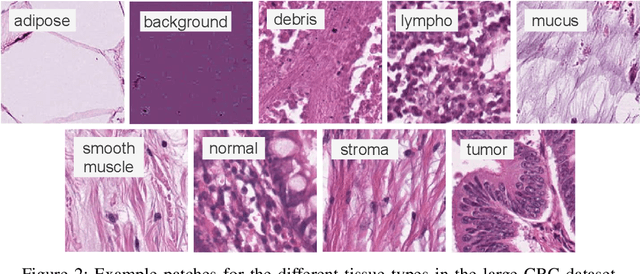 Figure 2 for Offline versus Online Triplet Mining based on Extreme Distances of Histopathology Patches