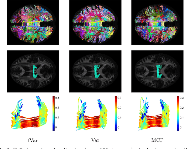 Figure 3 for White Matter Fiber Segmentation Using Functional Varifolds