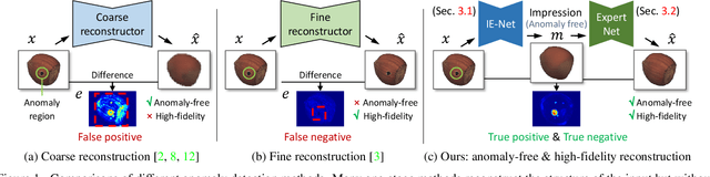 Figure 1 for Unsupervised Two-Stage Anomaly Detection