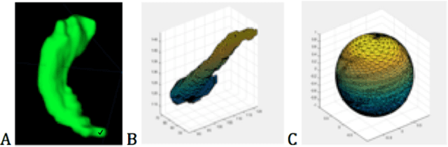 Figure 3 for Hippocampus Temporal Lobe Epilepsy Detection using a Combination of Shape-based Features and Spherical Harmonics Representation