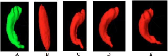 Figure 4 for Hippocampus Temporal Lobe Epilepsy Detection using a Combination of Shape-based Features and Spherical Harmonics Representation
