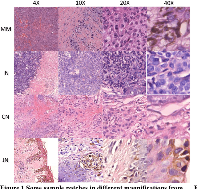 Figure 2 for Interpretable Classification from Skin Cancer Histology Slides Using Deep Learning: A Retrospective Multicenter Study