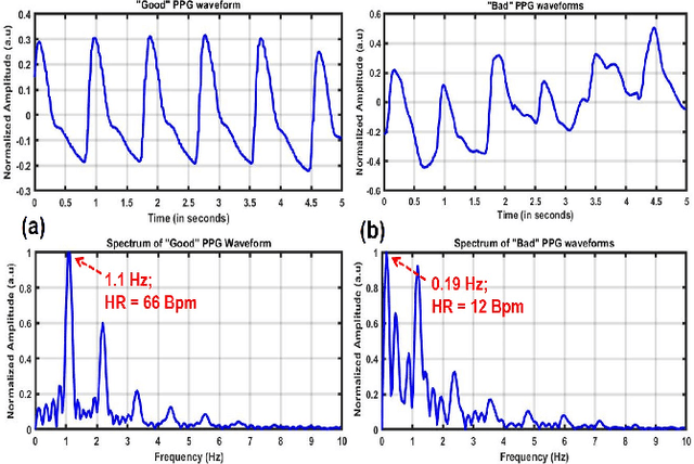 Figure 1 for Signal Quality Assessment of Photoplethysmogram Signals using Quantum Pattern Recognition and lightweight CNN Architecture