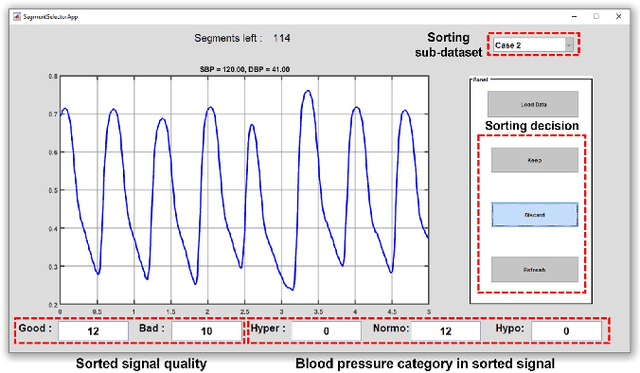 Figure 2 for Signal Quality Assessment of Photoplethysmogram Signals using Quantum Pattern Recognition and lightweight CNN Architecture