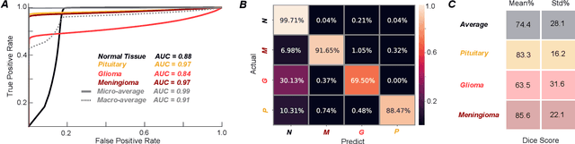 Figure 3 for QuickTumorNet: Fast Automatic Multi-Class Segmentation of Brain Tumors