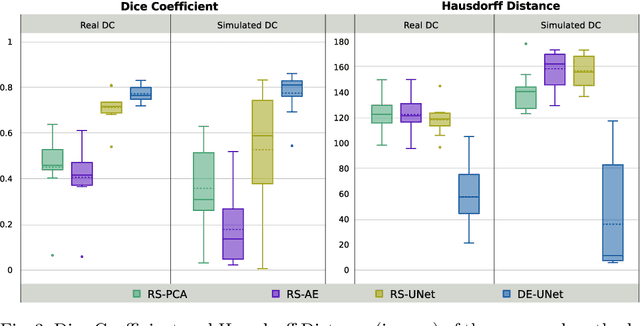 Figure 4 for Self-supervised Skull Reconstruction in Brain CT Images with Decompressive Craniectomy