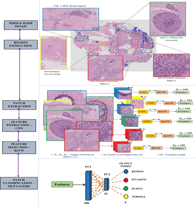 Figure 3 for Bag of Visual Words with Deep Features -- Patch Classification Model for Limited Dataset of Breast Tumours