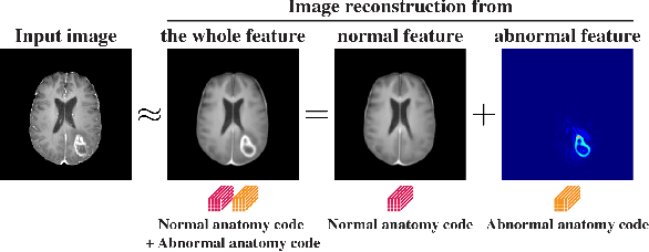 Figure 1 for Decomposing Normal and Abnormal Features of Medical Images for Content-based Image Retrieval