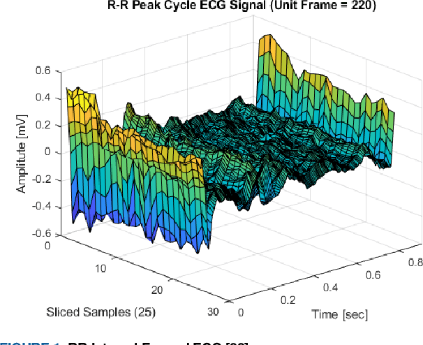 Figure 1 for An Enhanced Machine Learning-based Biometric Authentication System Using RR-Interval Framed Electrocardiograms