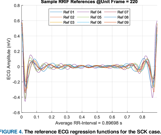 Figure 4 for An Enhanced Machine Learning-based Biometric Authentication System Using RR-Interval Framed Electrocardiograms