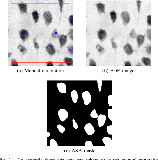 Figure 1 for Iterative Deep Learning Based Unbiased Stereology With Human-in-the-Loop