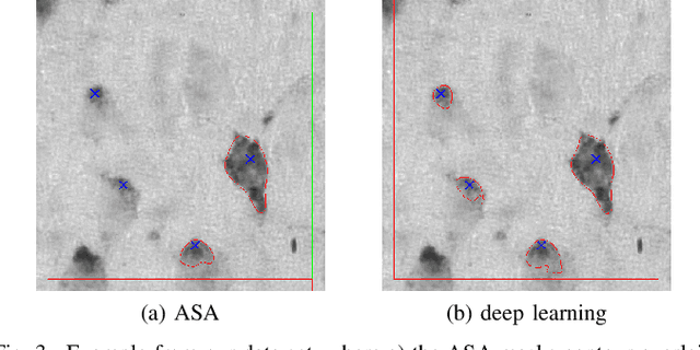 Figure 3 for Iterative Deep Learning Based Unbiased Stereology With Human-in-the-Loop