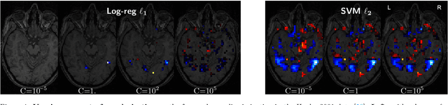 Figure 3 for Assessing and tuning brain decoders: cross-validation, caveats, and guidelines