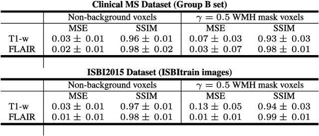 Figure 4 for Multiple Sclerosis Lesion Synthesis in MRI using an encoder-decoder U-NET