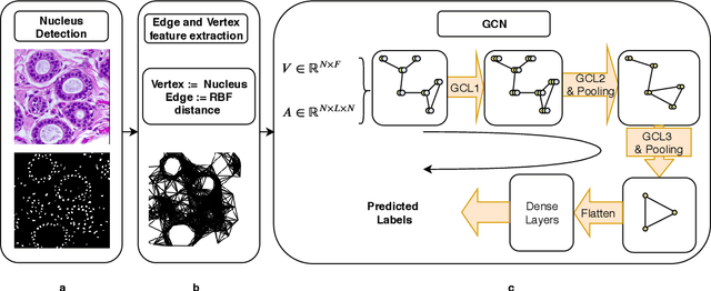 Figure 1 for Histographs: Graphs in Histopathology