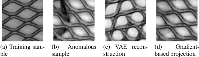 Figure 1 for Iterative energy-based projection on a normal data manifold for anomaly localization