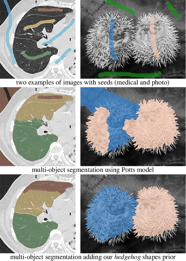 Figure 1 for A-expansion for multiple "hedgehog" shapes