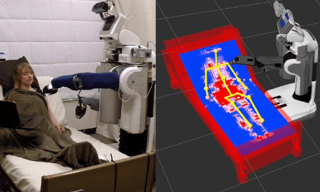 Figure 1 for 3D Human Pose Estimation on a Configurable Bed from a Pressure Image