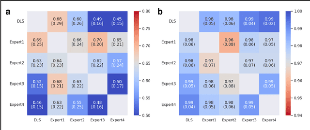 Figure 4 for Comparison of Deep Learning Segmentation and Multigrader-annotated Mandibular Canals of Multicenter CBCT scans
