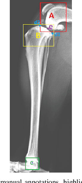 Figure 4 for Auto-Detection of Tibial Plateau Angle in Canine Radiographs Using a Deep Learning Approach