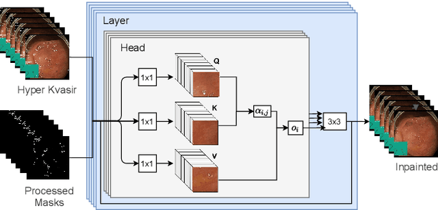 Figure 3 for A Temporal Learning Approach to Inpainting Endoscopic Specularities and Its effect on Image Correspondence