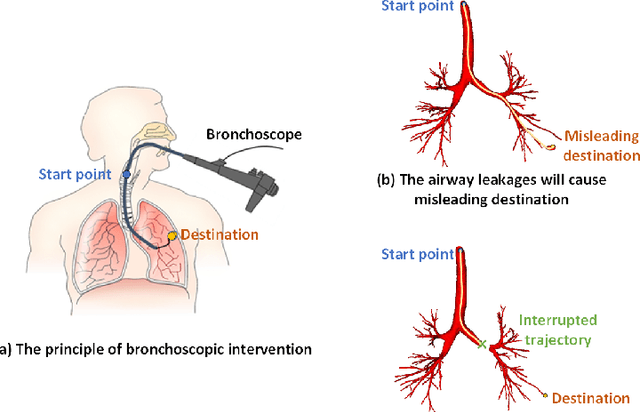 Figure 1 for LTSP: Long-Term Slice Propagation for Accurate Airway Segmentation