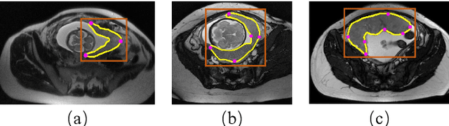 Figure 3 for MIDeepSeg: Minimally Interactive Segmentation of Unseen Objects from Medical Images Using Deep Learning