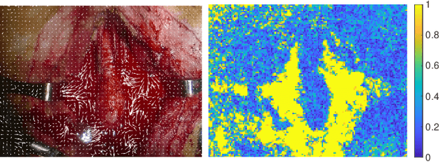 Figure 2 for Autonomous Robotic Suction to Clear the Surgical Field for Hemostasis using Image-based Blood Flow Detection
