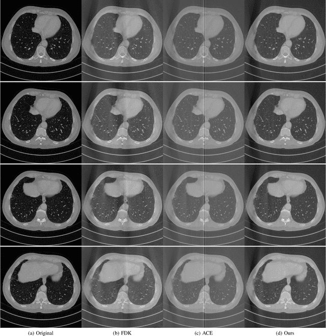 Figure 4 for A New Weighting Scheme for Fan-beam and Circle Cone-beam CT Reconstructions