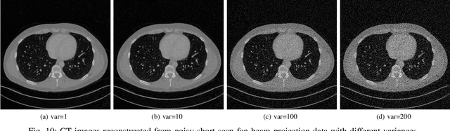 Figure 2 for A New Weighting Scheme for Fan-beam and Circle Cone-beam CT Reconstructions