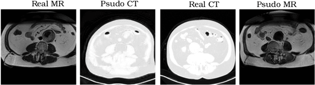 Figure 1 for Unsupervised learning for cross-domain medical image synthesis using deformation invariant cycle consistency networks