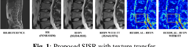 Figure 1 for Reference-based Texture transfer for Single Image Super-resolution of Magnetic Resonance images