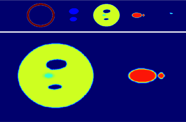 Figure 3 for Reducing the Gibbs effect in multimodal medical imaging by the Fake Nodes Approach