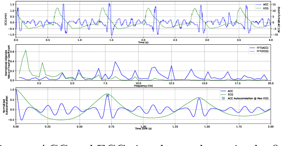 Figure 1 for Accelerometry-based classification of circulatory states during out-of-hospital cardiac arrest
