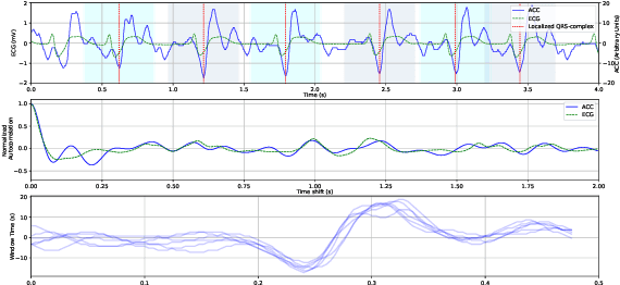Figure 3 for Accelerometry-based classification of circulatory states during out-of-hospital cardiac arrest