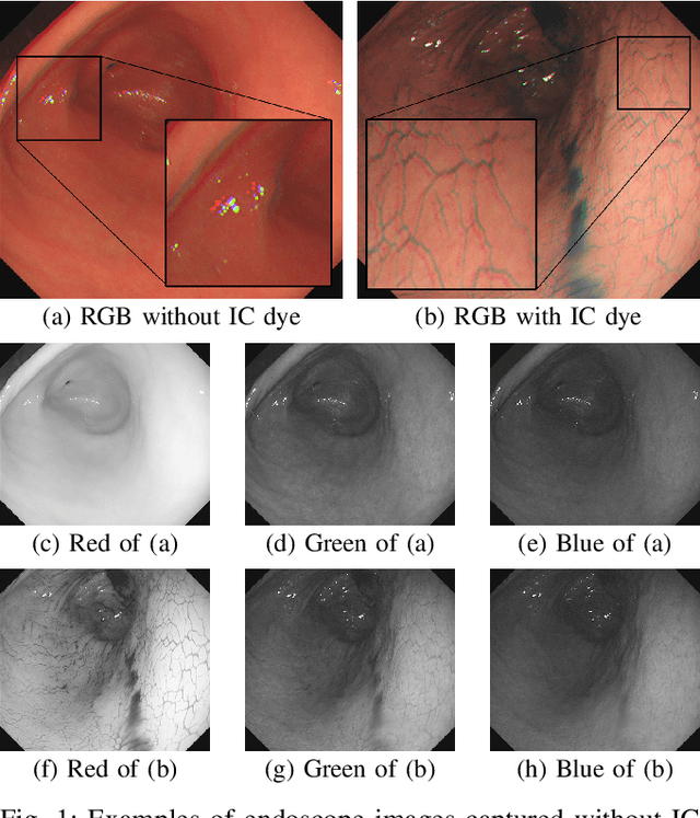 Figure 1 for 3D Reconstruction of Whole Stomach from Endoscope Video Using Structure-from-Motion