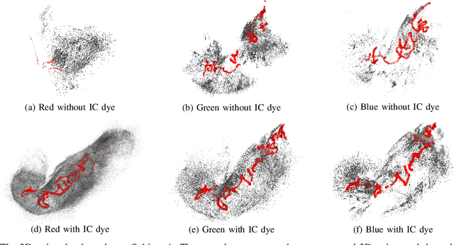 Figure 2 for 3D Reconstruction of Whole Stomach from Endoscope Video Using Structure-from-Motion