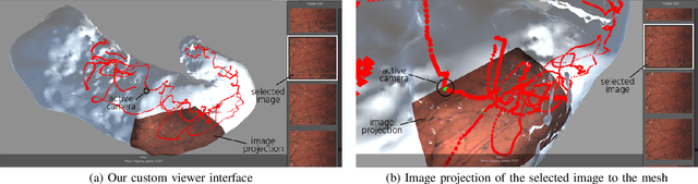 Figure 4 for 3D Reconstruction of Whole Stomach from Endoscope Video Using Structure-from-Motion