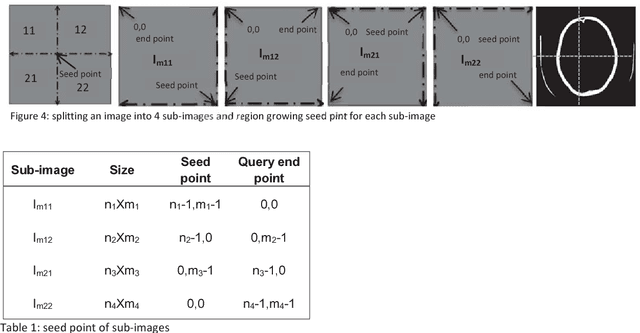 Figure 2 for An Automatic Method for Complete Brain Matter Segmentation from Multislice CT scan