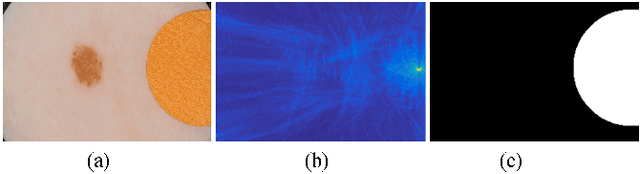 Figure 4 for Supervised Saliency Map Driven Segmentation of the Lesions in Dermoscopic Images