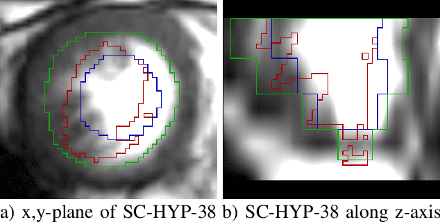 Figure 3 for One Shot Learning for Deformable Medical Image Registration and Periodic Motion Tracking
