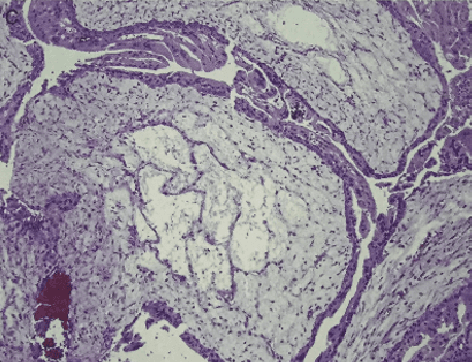 Figure 1 for Segmentation Network with Compound Loss Function for Hydatidiform Mole Hydrops Lesion Recognition
