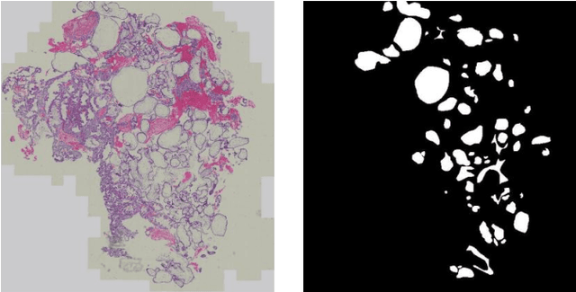 Figure 3 for Segmentation Network with Compound Loss Function for Hydatidiform Mole Hydrops Lesion Recognition