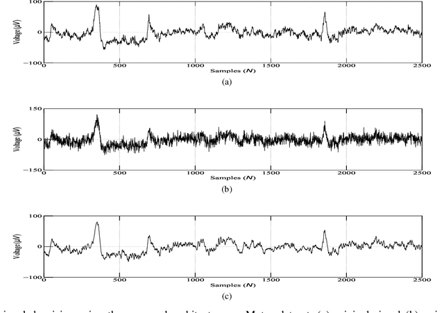Figure 3 for Orthogonal Features-based EEG Signal Denoising using Fractionally Compressed AutoEncoder