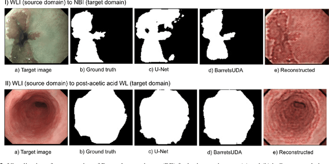 Figure 4 for Unsupervised Adversarial Domain Adaptation For Barrett's Segmentation