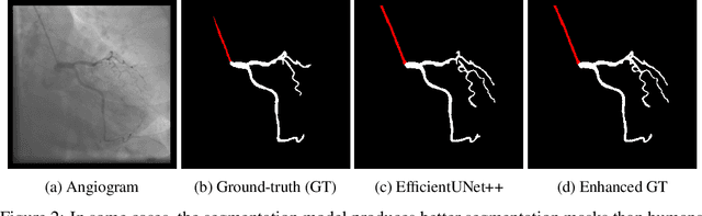 Figure 2 for Encoder-Decoder Architectures for Clinically Relevant Coronary Artery Segmentation